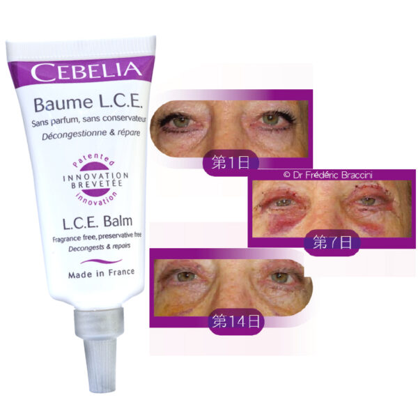 Cebelia 【修復癒合霜】 L.C.E. Balm 寡胜肽再生