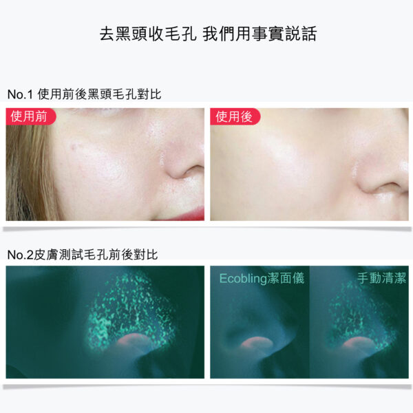 YUSKIN 【黑頭剋星】 硅膠潔面儀
