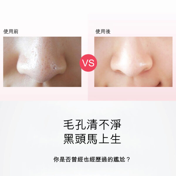 YUSKIN 【黑頭剋星】 硅膠潔面儀